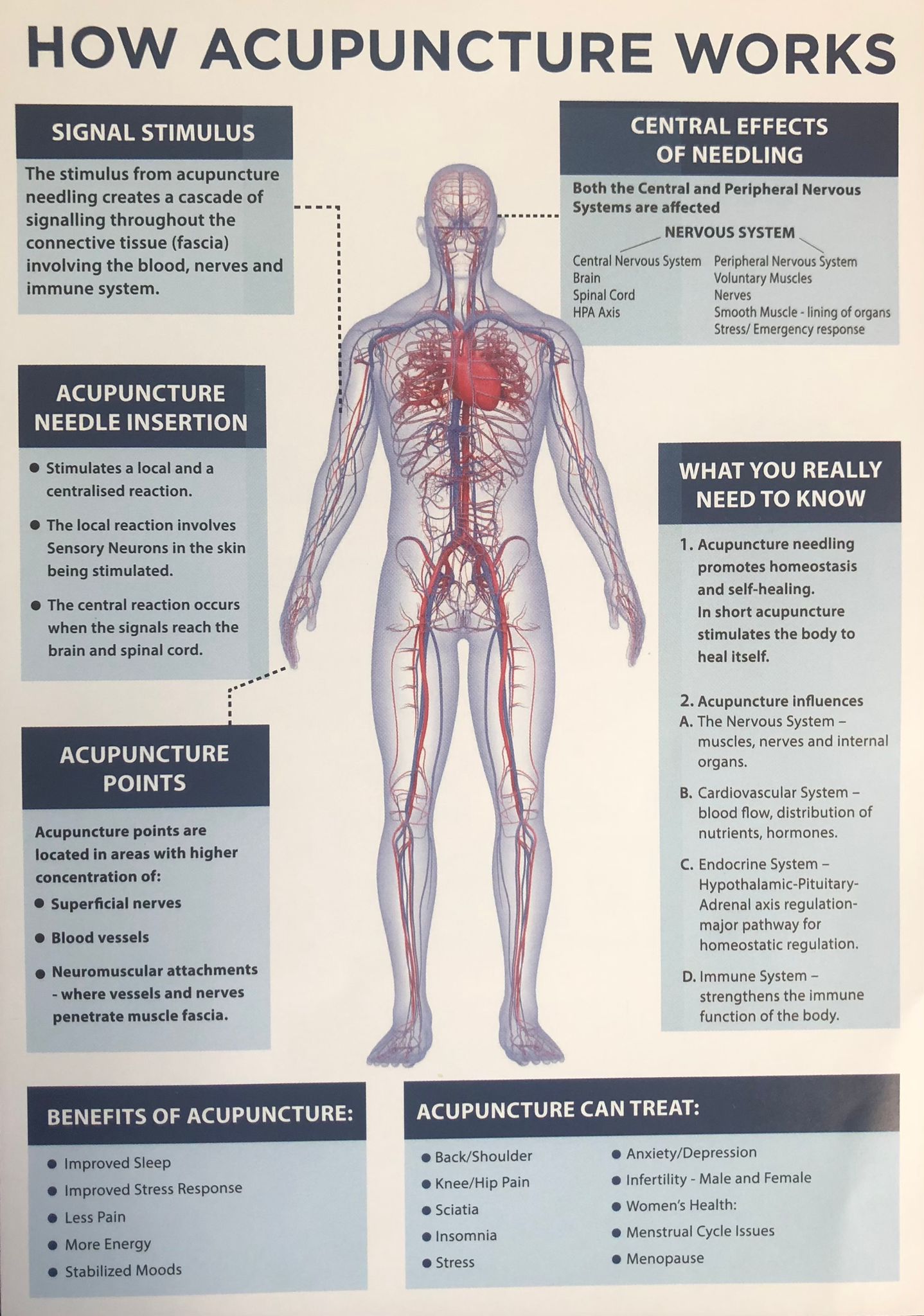 Acupuncture - How It Works